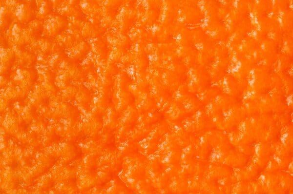 La cellulite est une répartition particulière de la graisse corporelle, se concentrant sur certaines régions (hanches, cuisses, fesses) et présentant un aspect de peau d'orange.